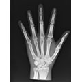 X-Ray Phantom Hand, transparent 3